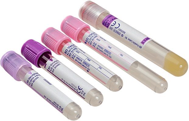 SPECIMEN TUBES VACUTAINER PACK OF 100